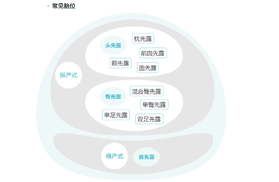 【育儿科普】分娩最佳顺产胎位是什么样子?_新浪财经_新浪网
