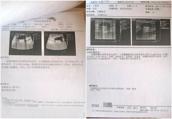 医院割睾丸图片