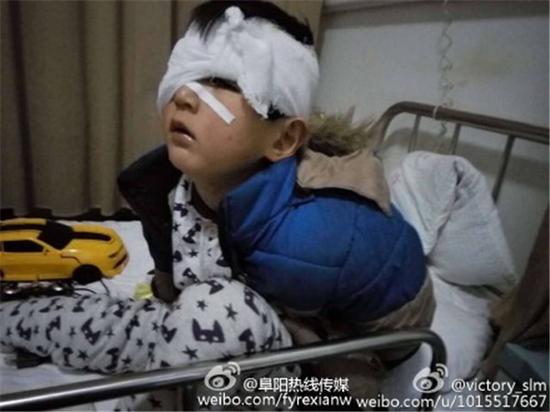 7岁男孩眼睛被抠瞎摘除 行凶者疑心智不全