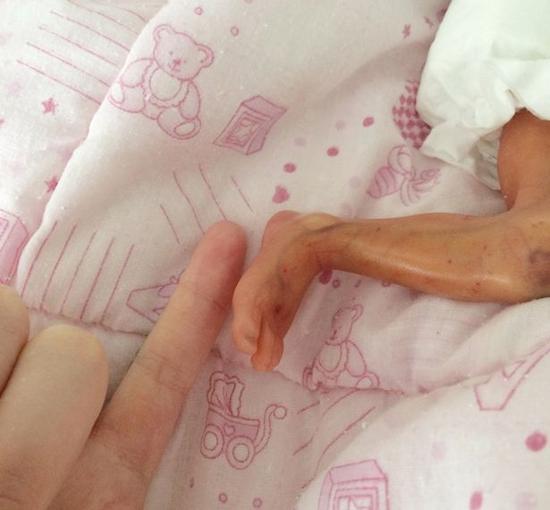 一个半升玻璃杯大小,头部大概只有一个小蜜橘大,这名小婴儿叫做lydia