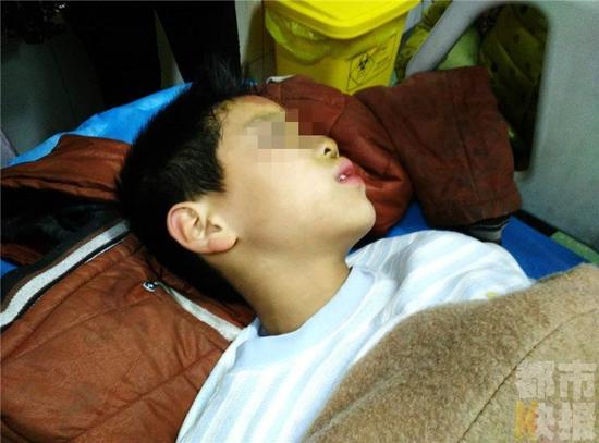 男子暴打11岁男童