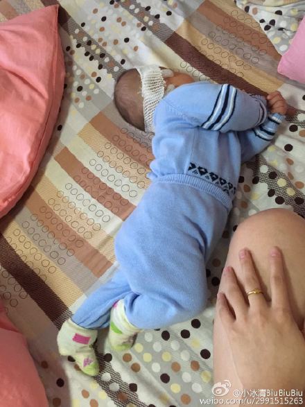 怀疑肌张力高怎么自查