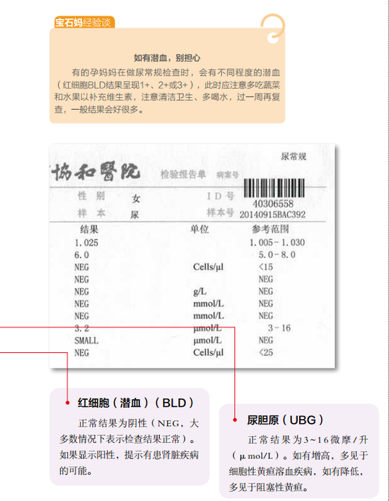 教你看懂尿常规化验单验尿常规, 看看你的肾脏功能是否能承受 孕期