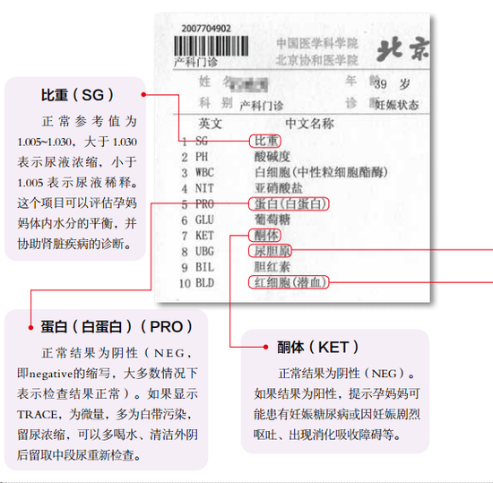 验尿常规看看肾功能是否能承受孕期生理变化