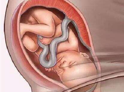 胎儿什么时候会入盆入盆有什么感觉