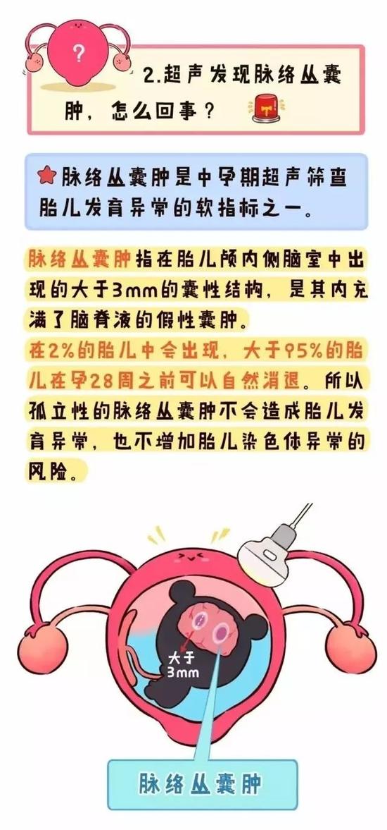 孕期b超大排畸都查什么?