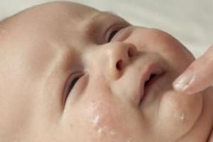 孩子长湿疹有什么办法缓解？