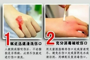 暑期安全 狂犬病致死率100% 收藏急救处理小知识