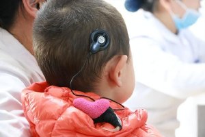 人工耳蜗入医保 让更多患儿重获新“声”