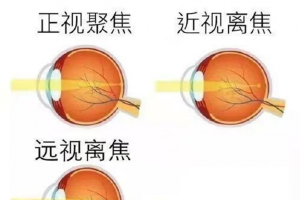 預防兒童近視 家長們要注意這三個問題