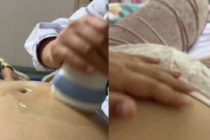 孕期護理：準媽媽如何做好日常保健？