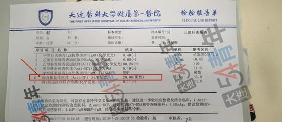 大连医科大学附属第一医院检验报告单显示,赵某恒检测的"梅毒螺旋体