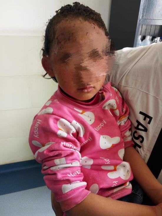 受伤的小女孩.受访者供图