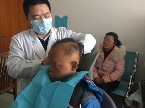 重庆男孩患怪病酷似"吸血鬼" 长有獠牙且畏光