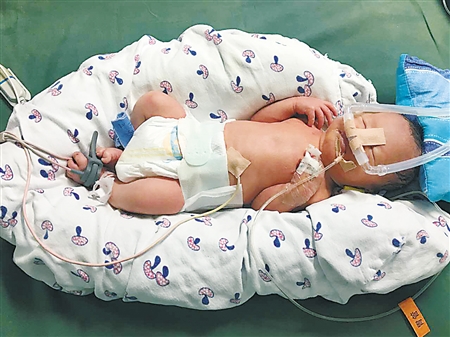 88厘米高妈妈生下4斤重儿子 宝宝以后能长高吗?