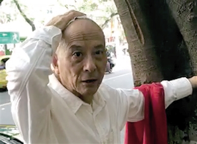 高空坠物砸伤本土明星仇小豹.本报记者 雷键 摄