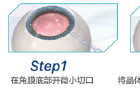 宝宝眼睛水汪汪，警惕婴幼儿泪囊炎