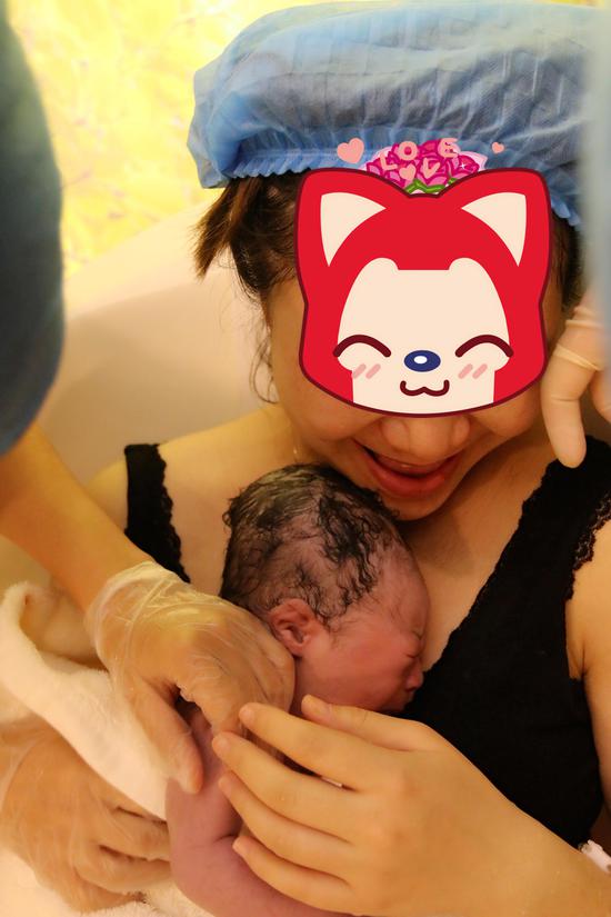 重庆首例水中分娩成功实施海豚宝宝真的来啦