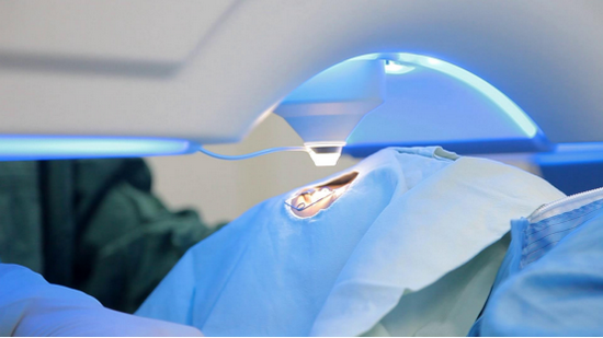 激光近视手术时我动了会不会有危险重庆爱尔总院专家来解答