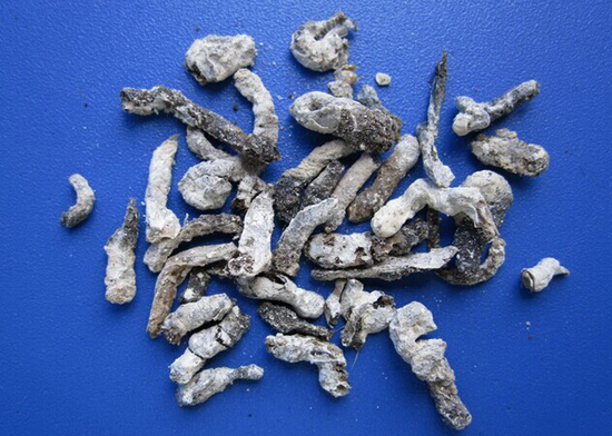 重口味疗法 吃"大便"药丸不如喝"粪"药汤