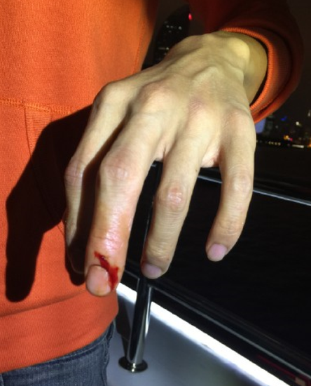 谢霆锋病历网络疯传谴责发布者侵犯隐私