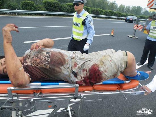 车祸瞬间父爱如山 父亲舍身救了16岁儿子 