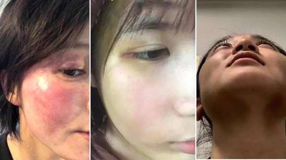 “铁拳男孩”出道！这些明星被爆出家暴