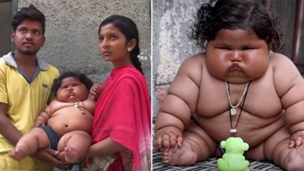 印度一岁女婴体重35斤 食量和4岁儿童相当