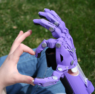 3岁男孩天生无右手手指:3d打印义肢