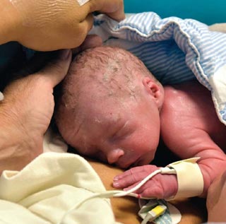 全球首例"移植子宫"内孕育婴儿降生