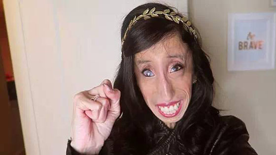 世界最丑女人演讲助人找自信