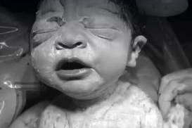 震撼特写！自然剖腹的宝宝靠自己力量爬出母体