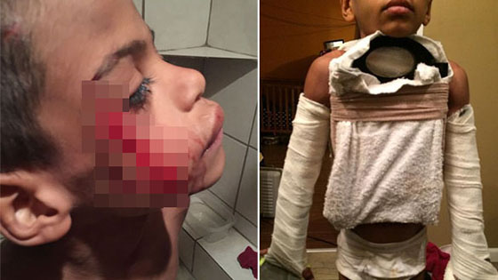 美国父母将7岁儿子虐待致死 为毁尸灭迹将尸体喂猪