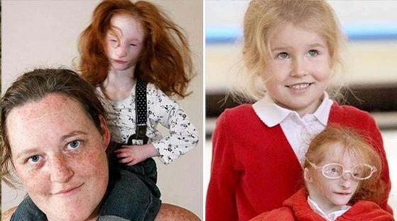 现实版拇指姑娘：比兔子还小