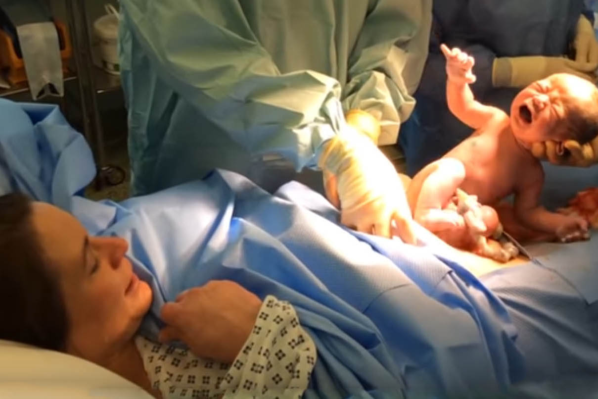 宝宝靠自己力量爬出母体 特殊分娩视频撼动百万人
