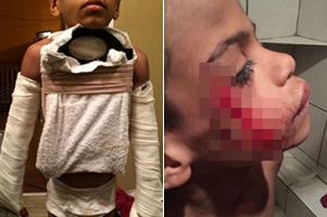 灭绝人性！夫妇虐待7岁男孩致死 尸体喂猪