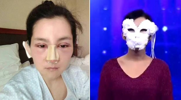 女孩整容失败 揭开面具一刻主持人差点跳起来