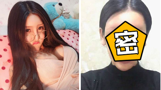 吓哭！97年女网红脸上玻尿酸溶解惨毁容