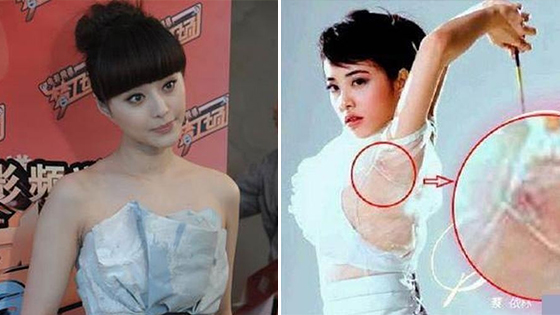 这些疤痕出卖了女明星的纯天然