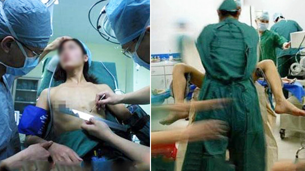 泰国人妖变性全过程 画面太美不敢看