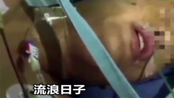 男子做开颅手术 唱《古惑仔》主题曲：一点都不痛