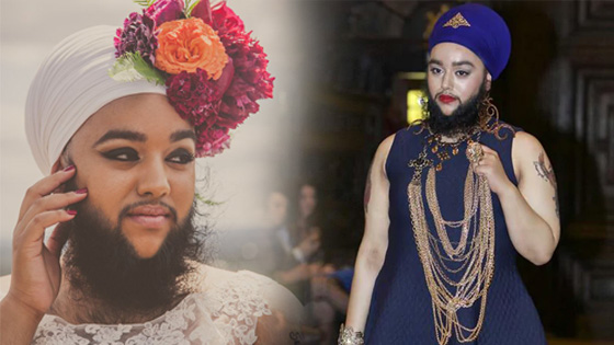 花季少女患怪病脸上长满胡子 上t台惊艳