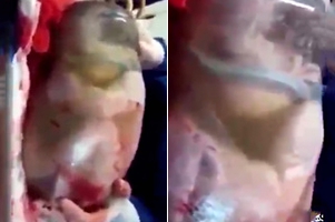 婴儿出生时羊水囊未破 700万人在线观看