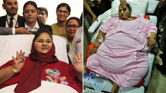 全球最胖女子去世 曾重达1000斤卧床25年