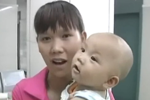 婴儿眼睛有白点 医生检查后称差点出大事