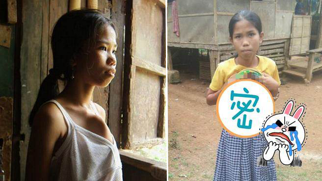 少女肚子长出神秘双手 还得照顾帮剪指甲