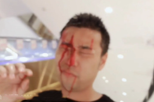 户外主播直播时被劝酒 后遭人酒瓶砸头