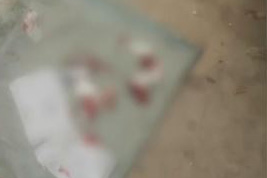 8岁女孩遭老师殴打下体流血？ 各方说法