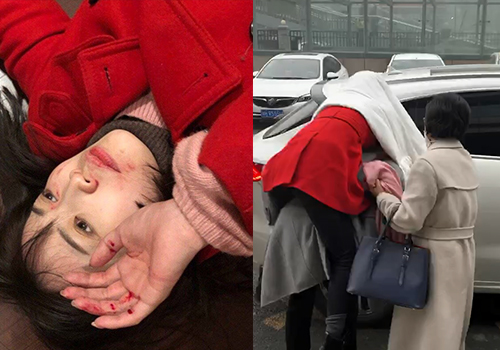 马蓉被人背着快速跑离医院！骨科检查无大碍