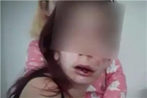 智障女孩遭3未成年少女围殴 被逼吃玻璃